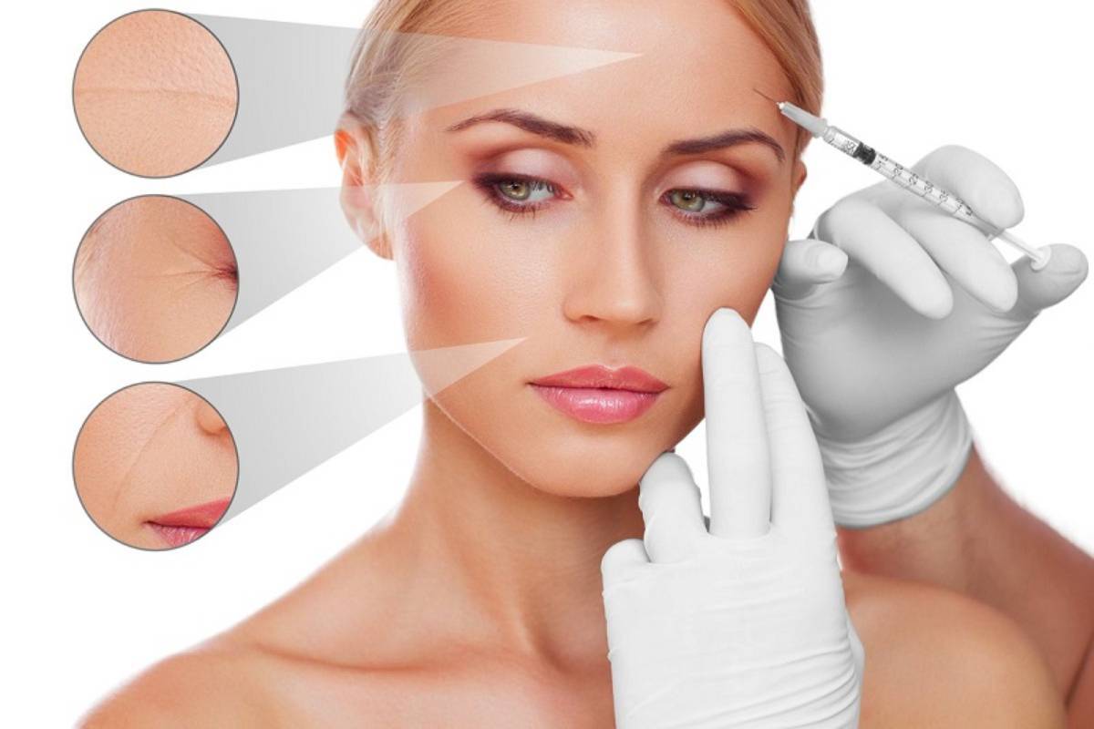 Lưu ý khi lựa chọn Filler và Botox để làm đẹp